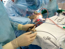 Нейрохирургия Ультразвуковой допплеровский расходомер, применение метода высокочастотной допплерографии в клинической практике